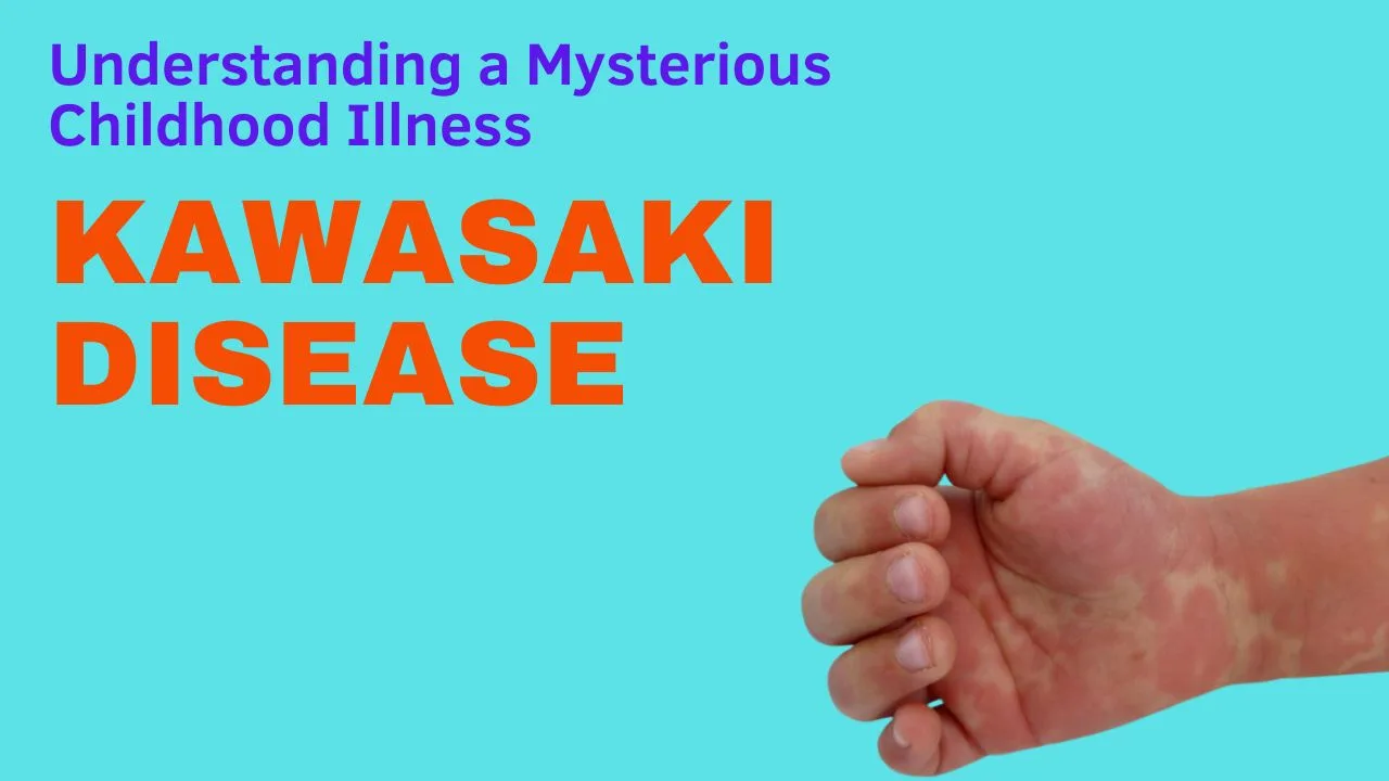 Kawasaki Disease: Understanding a Mysterious Childhood Illness ...