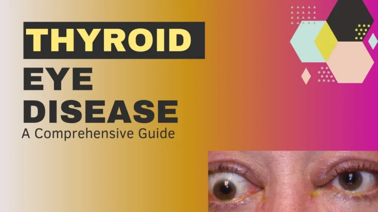 Understanding Thyroid Eye Disease: A Comprehensive Guide